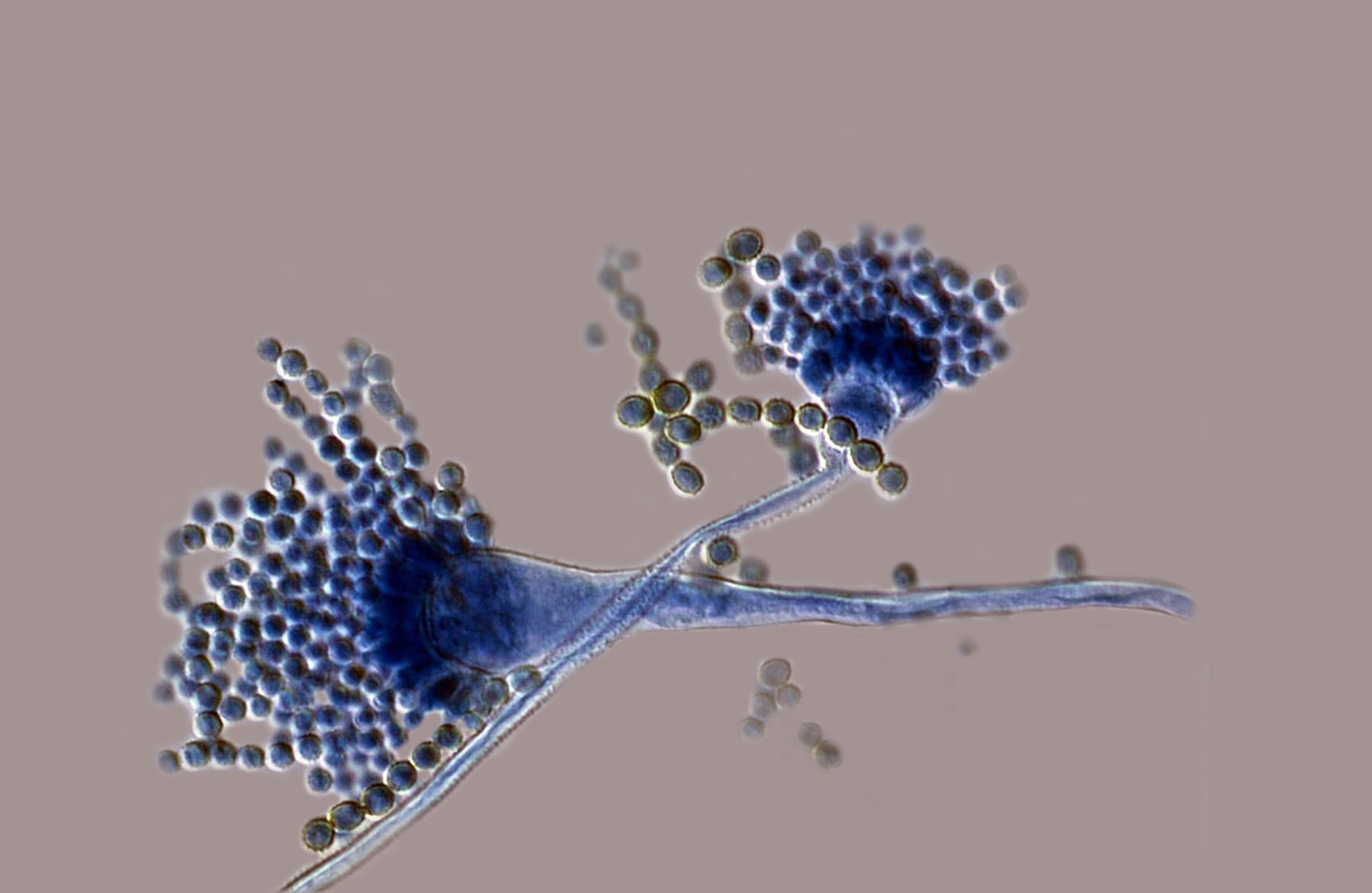 Aspergillus.jpg
