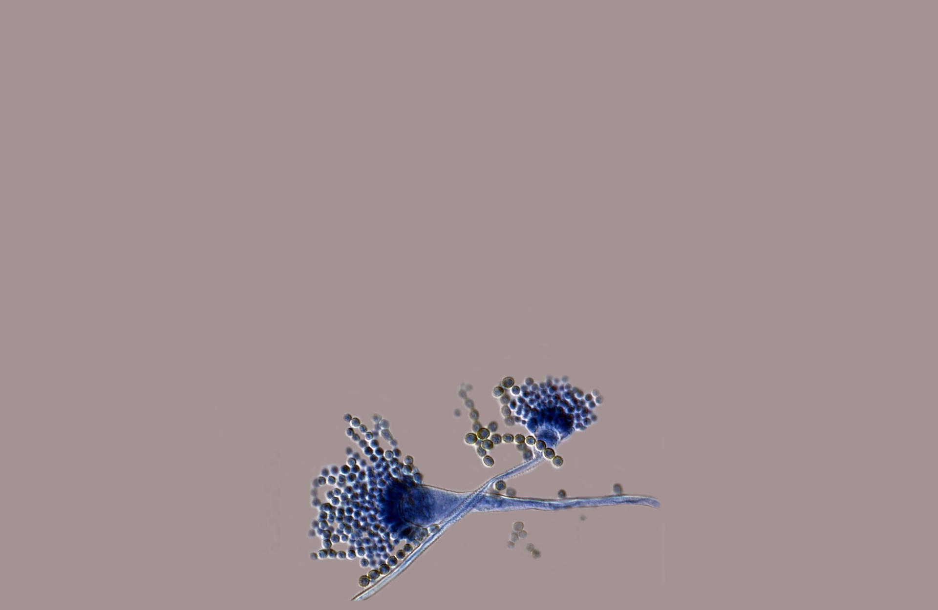 Aspergillus.jpg